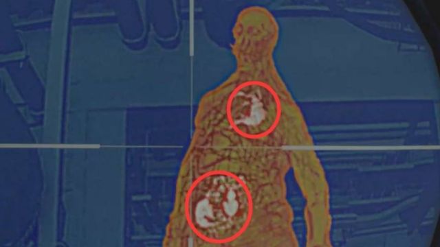《生化危機4：重製版》再生者能殺死嗎？